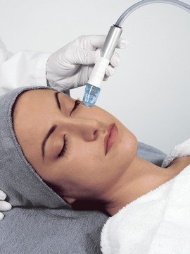 Chemical peel or Dermabrasion